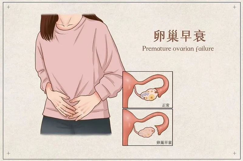 1646115830816427.jpg 卵巢早衰.jpg