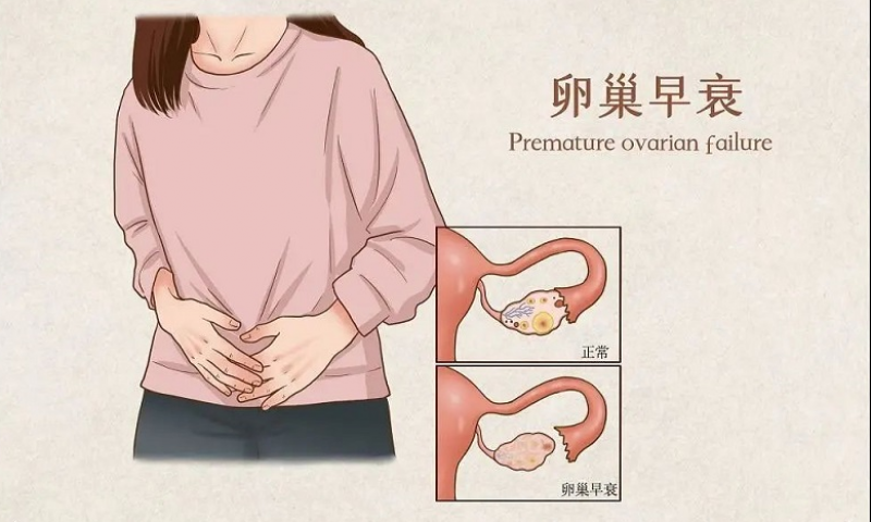 女性卵巢早衰，男性不育可用仲景左歸丸調(diào)理