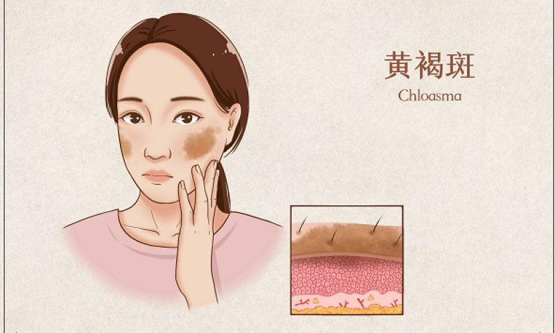 女人肝不好的三大癥狀，仲景逍遙丸春季養(yǎng)好肝一年少生病